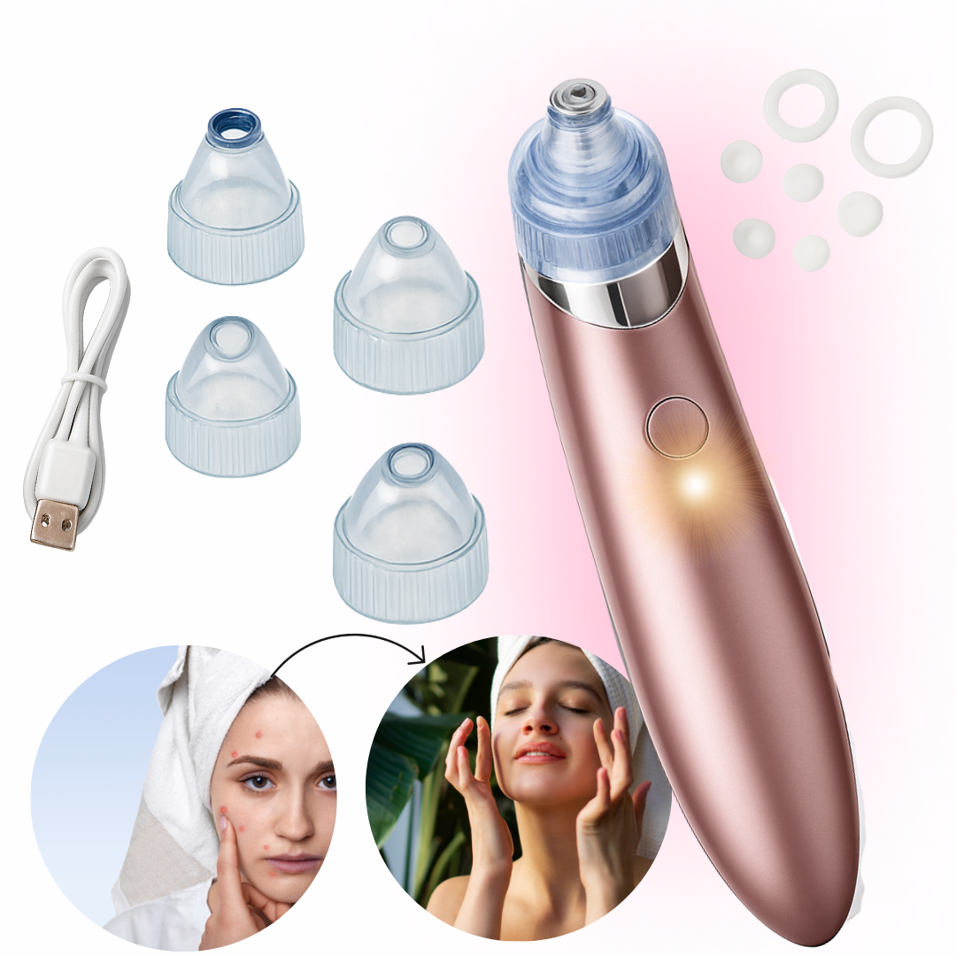 Blackhead vacuum cleaner, SKU: 316