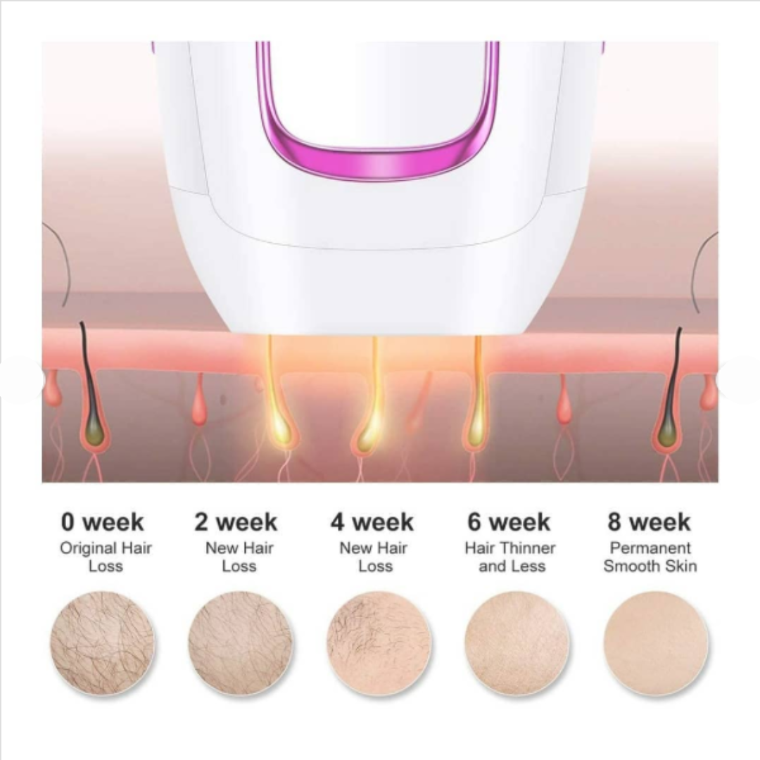 IPL Laser Hair Removal Device, SKU: 7012