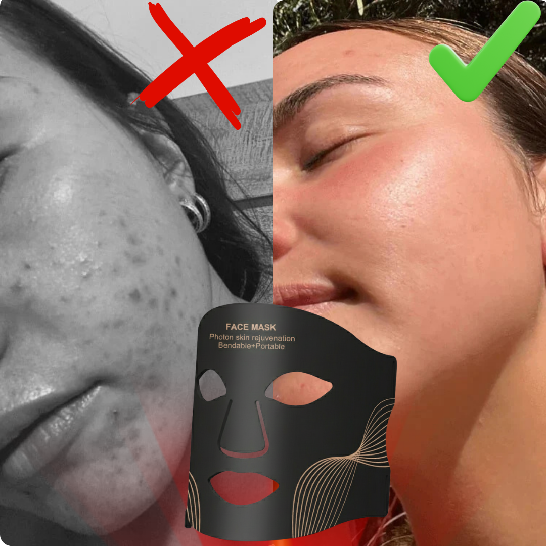 Professional 7-Color LED Face Mask, SKU: 7054